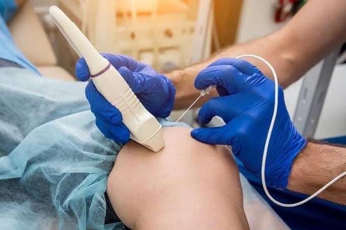 افضل دكتور علاج الألم في مصر